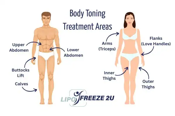 Graphic showing where you can have Body toning Treatment Walham Green on your body
