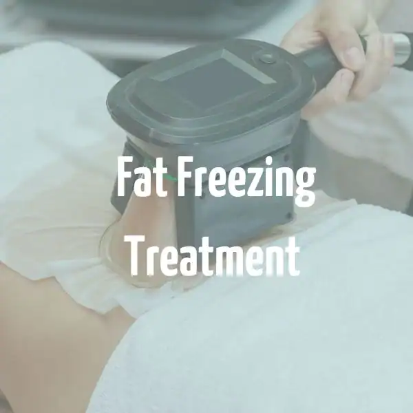fat freezing treatment Walham Green