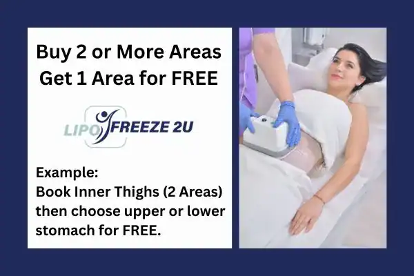 fat freezing prices Walham Green