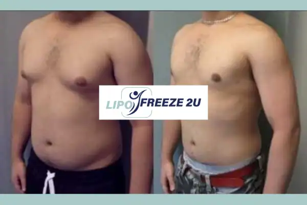 How Long Does It Take to See Results Walham Green?