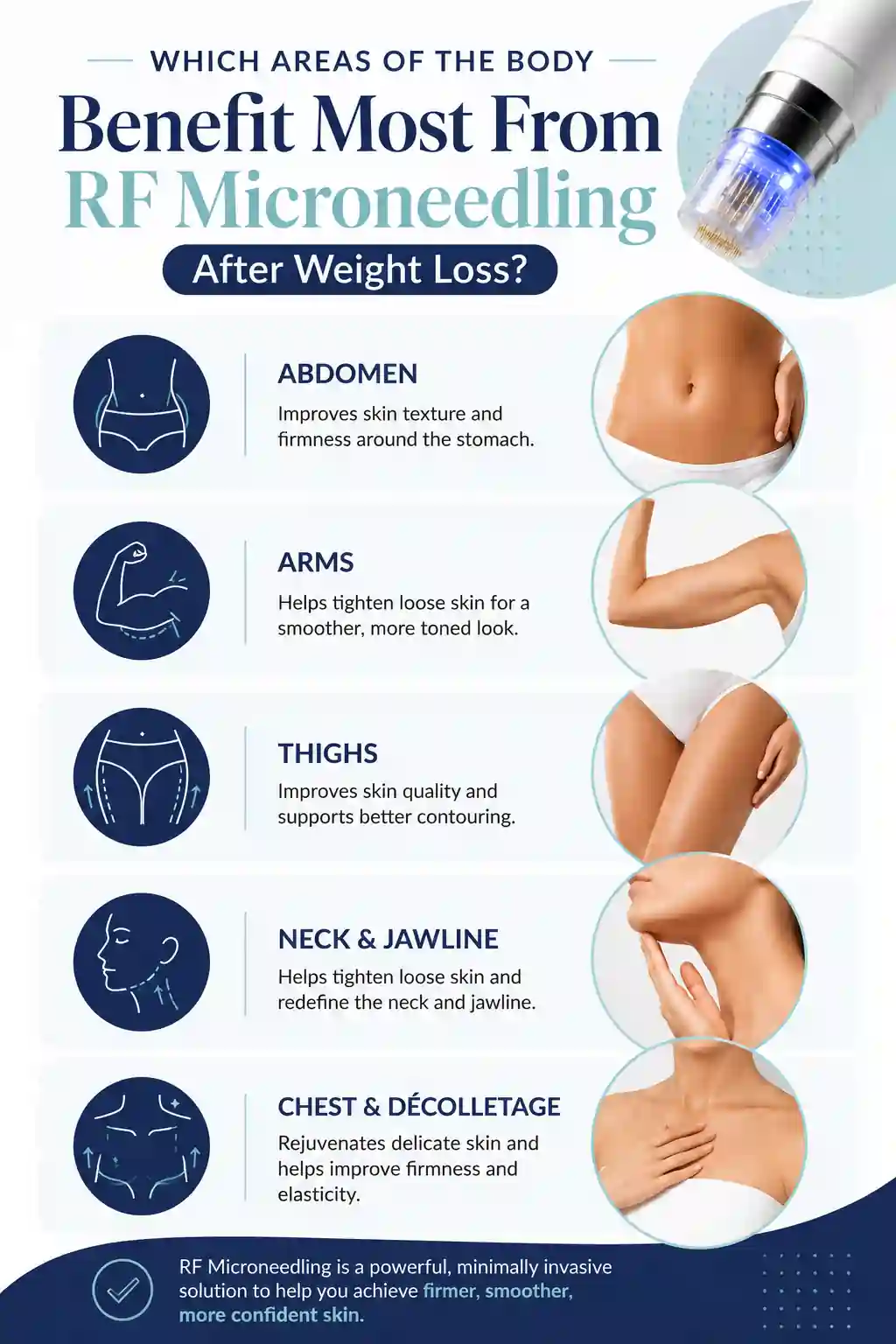 Which Areas of the Body Benefit Most From RF Microneedling After Weight Loss Walham Green