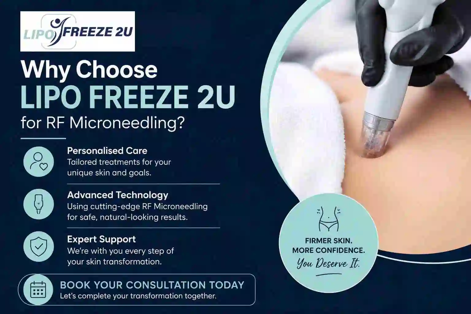 Why Choose LIPO FREEZE 2U for RF Microneedling Walham Green?
